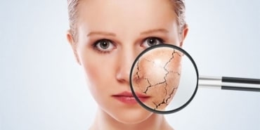 Cildiniz için kışa hazırlık reçetesi