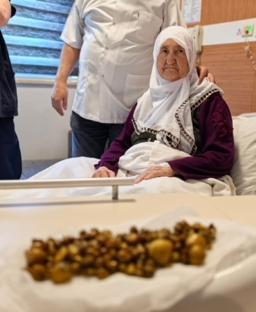 DOKTORLAR GÖZLERİNE İNANAMADI 77 YAŞINDAKİ KADININ SAFRA KESESİNDEN 213 ADET TAŞ ÇIKTI